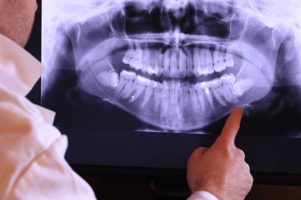 Best Orthodontic Emergency Dentist in Bayou Lourse, LA