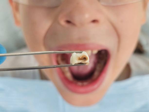 Best Weekend Emergency Dentist in Bayou Lourse, LA