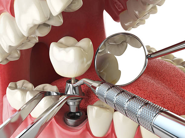Best Emergency Cosmetic Dentistry in Bayou Lourse, LA