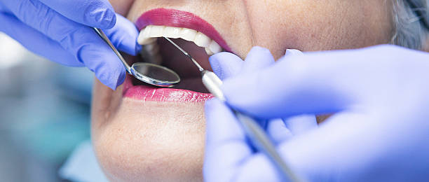 Best Emergency Dentist for Knocked-Out Tooth in Bayou Lourse, LA